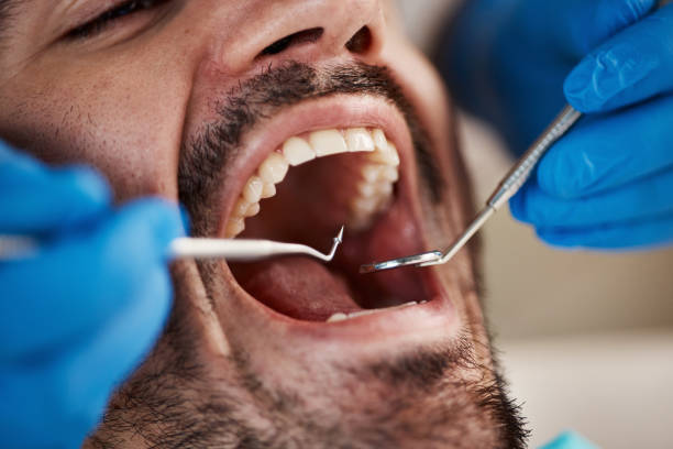 Best Emergency Root Canal Treatment in Winooski, VT