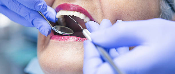 Best Emergency Dental Care for Abscessed Tooth in Winooski, VT